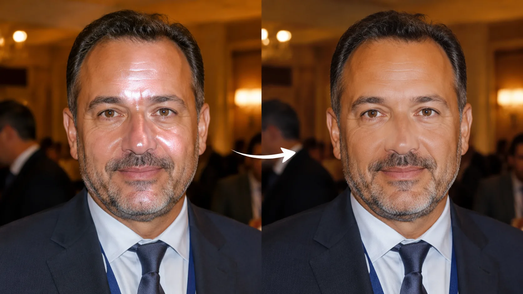 Fix Skin Oil and Flash Hotspots